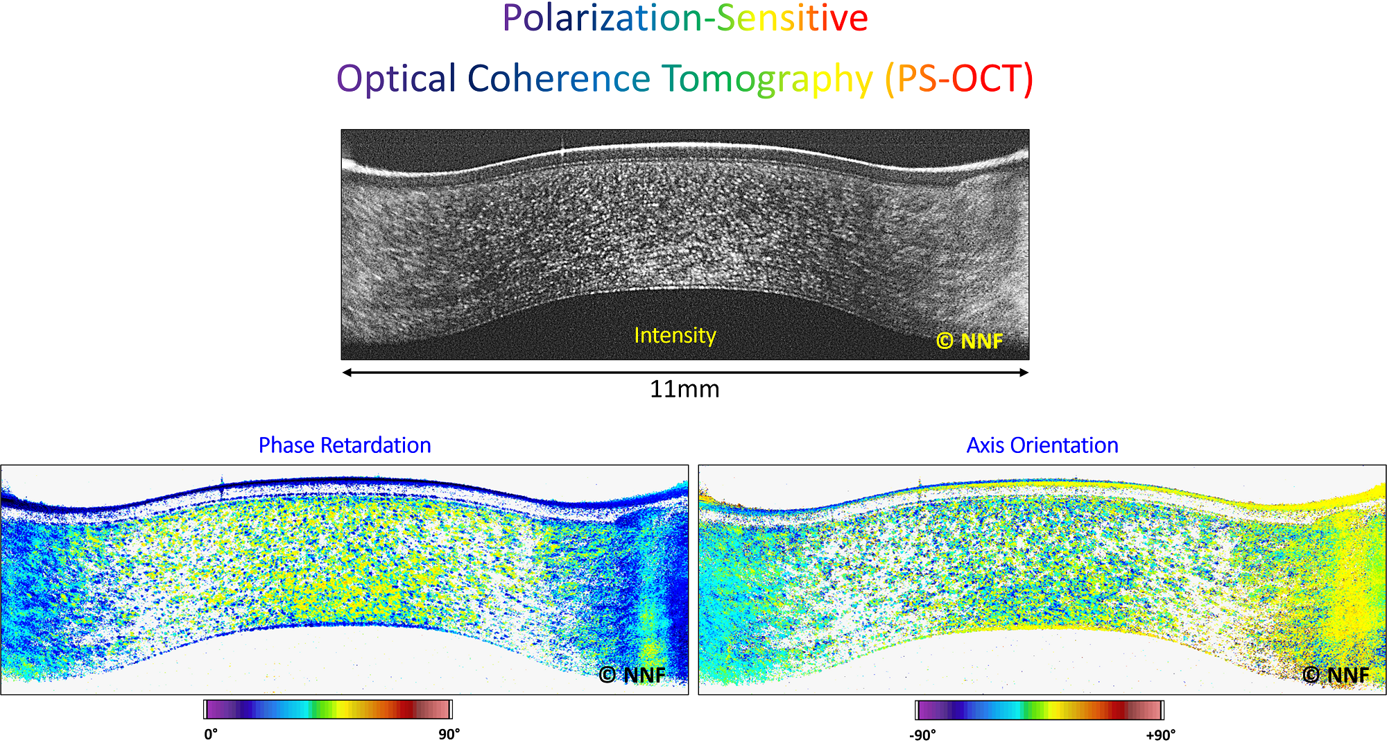 PS-OCT_Cornea